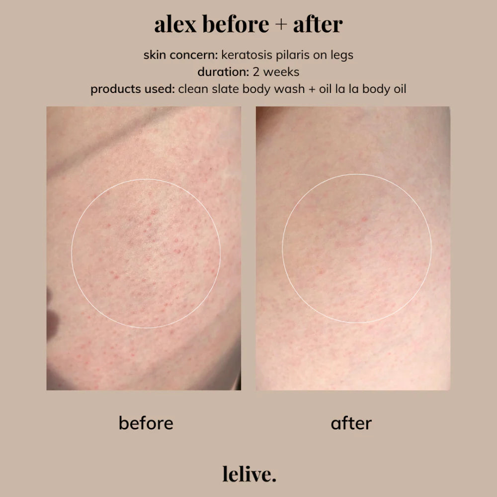 Body Glow Up: Mini Edition | 4-Piece Set