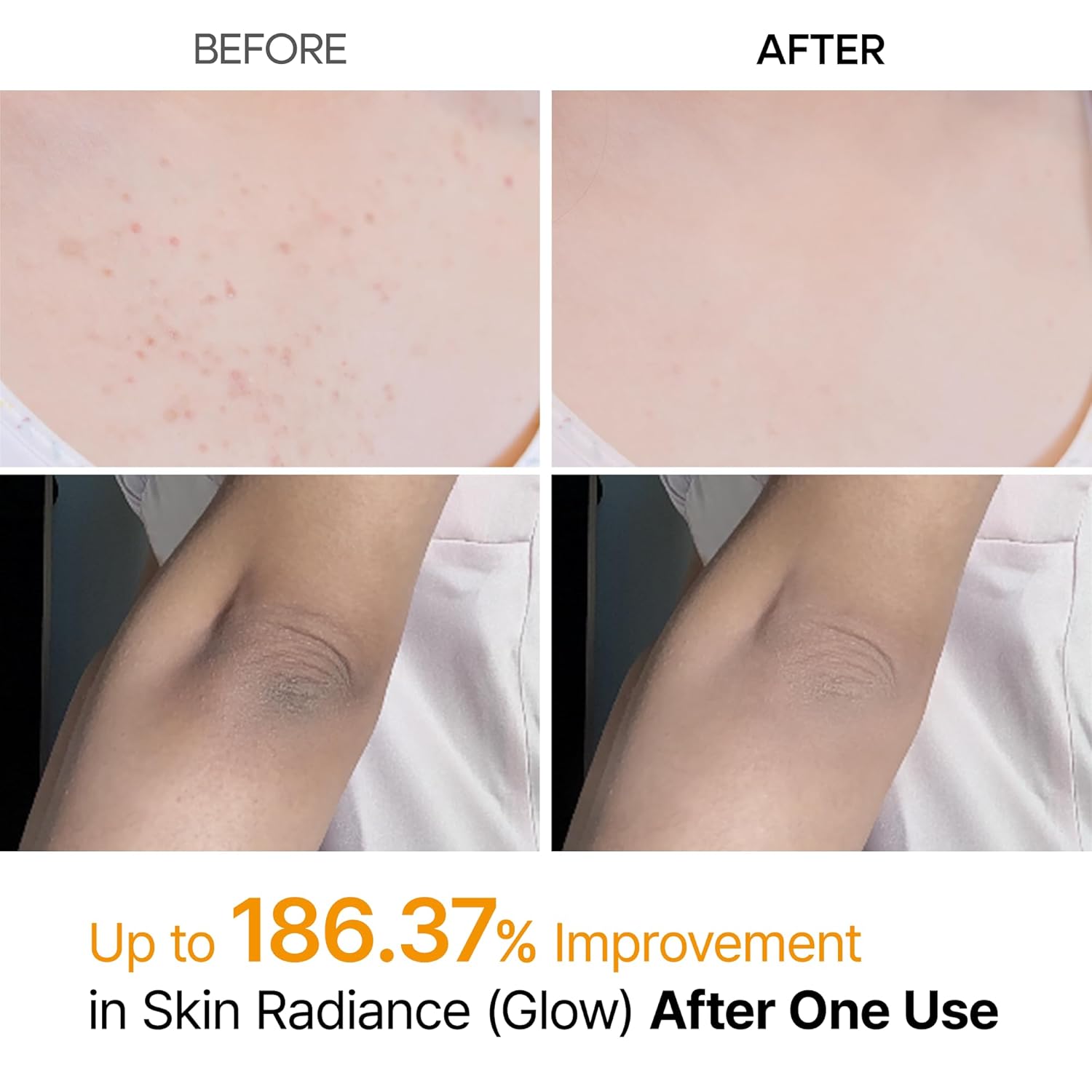 Body Peel Shot Spray Face Peeling Kojic Acid Turmeric Spray 200Ml