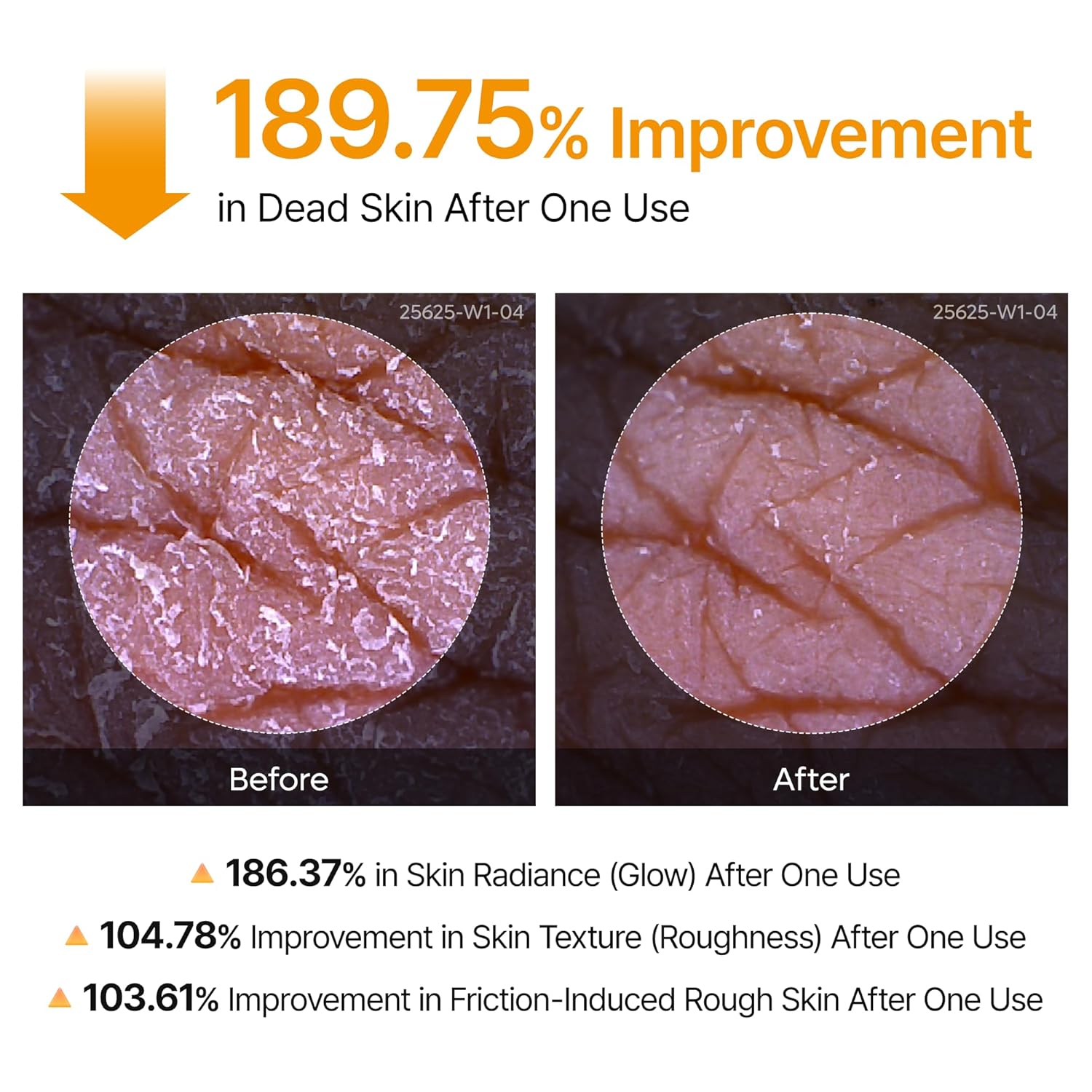 Body Peel Shot Spray Face Peeling Kojic Acid Turmeric Spray 200Ml